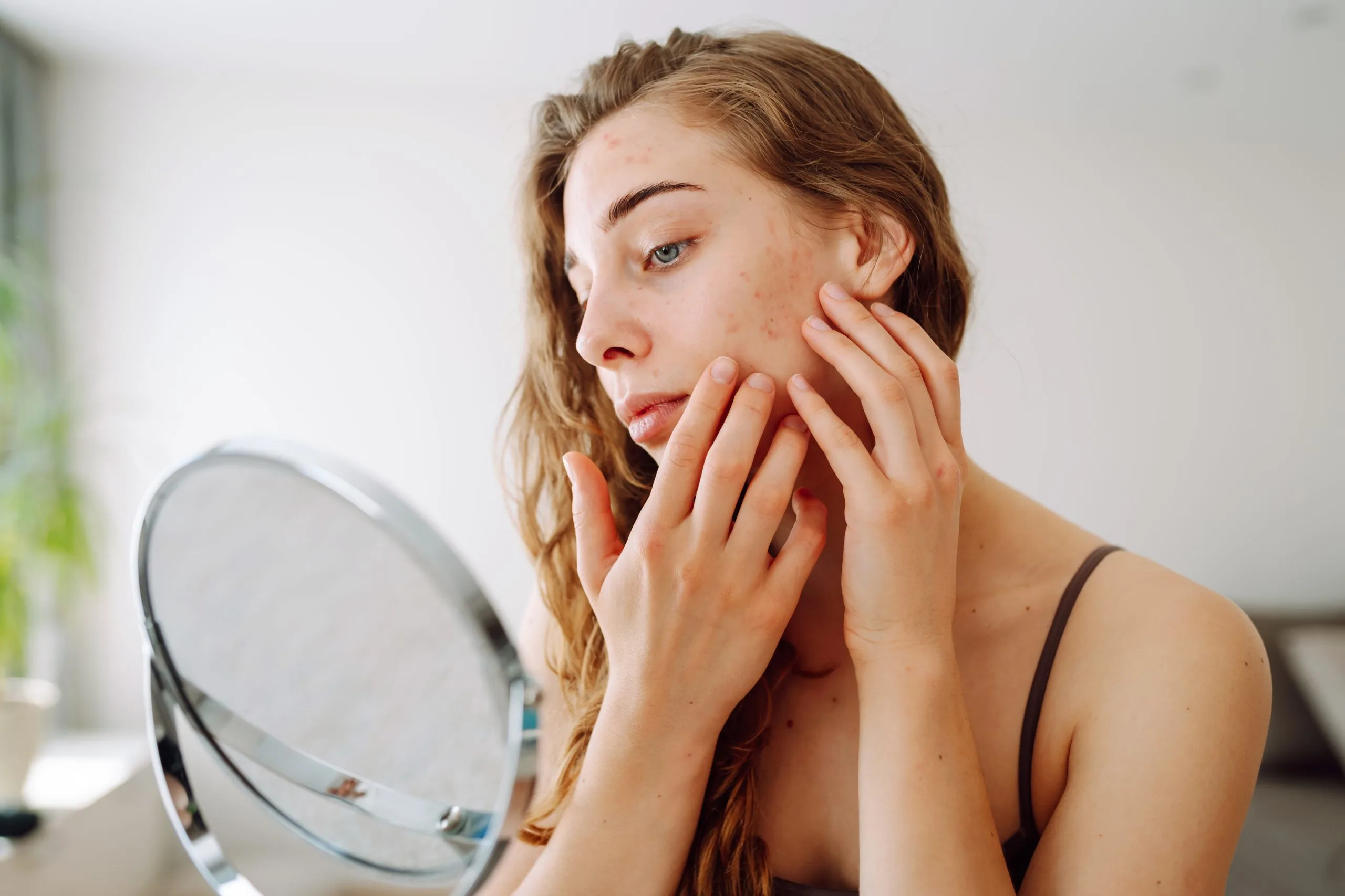 Woman examining acne on her cheek while looking in handheld mirror in bright indoor setting