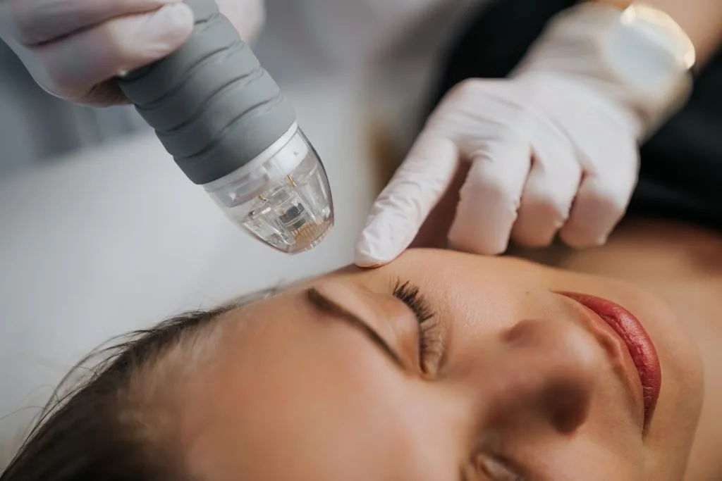 Practitioner holding microneedling device over patient's face during treatment